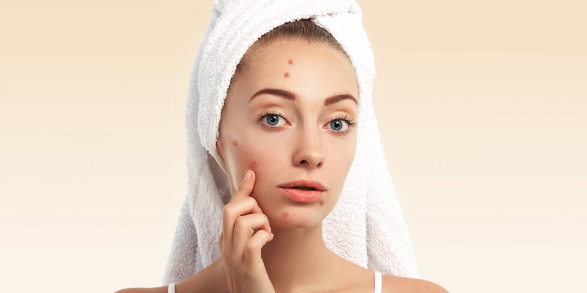 Close up isolated portrait of beautiful young Caucasian woman with blue eyes and problem skin, looking at the camera, pointing at pimple wearing white towel on her head against blue studio background